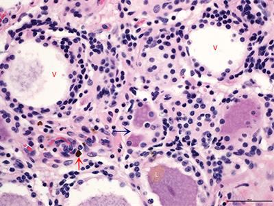 Dangerous Behavior and Intractable Axial Skeletal Pain in Performance Horses: A Possible Role for Ganglioneuritis (14 Cases; 2014–2019)